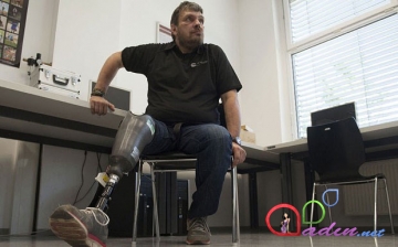 Dünyada bir ilk - hiss edilən protez (FOTO)