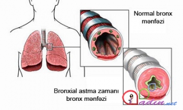 Astma və boğulma