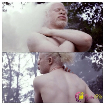 Albinosların qeyri-adi gözəlliyi