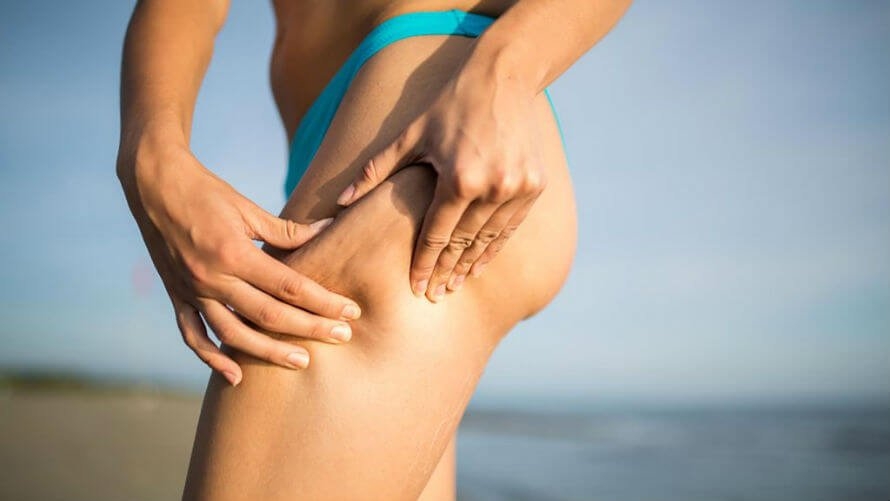 4 foods that fight cellulite